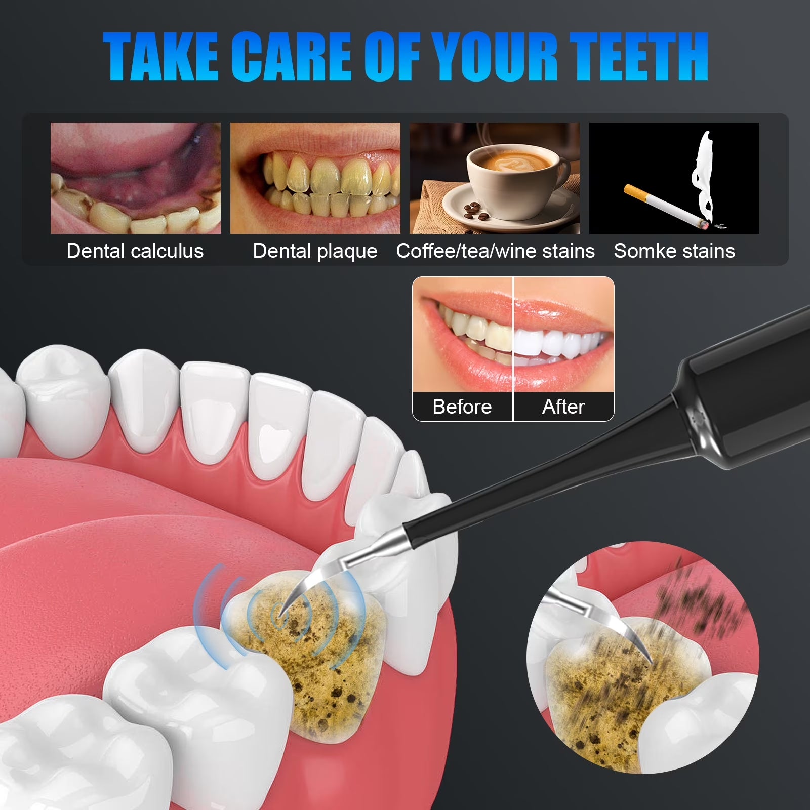 Electric Dental Calculus Remover for Adult Kids - Dental Cleaning Kit with 6 Adjustable Modes