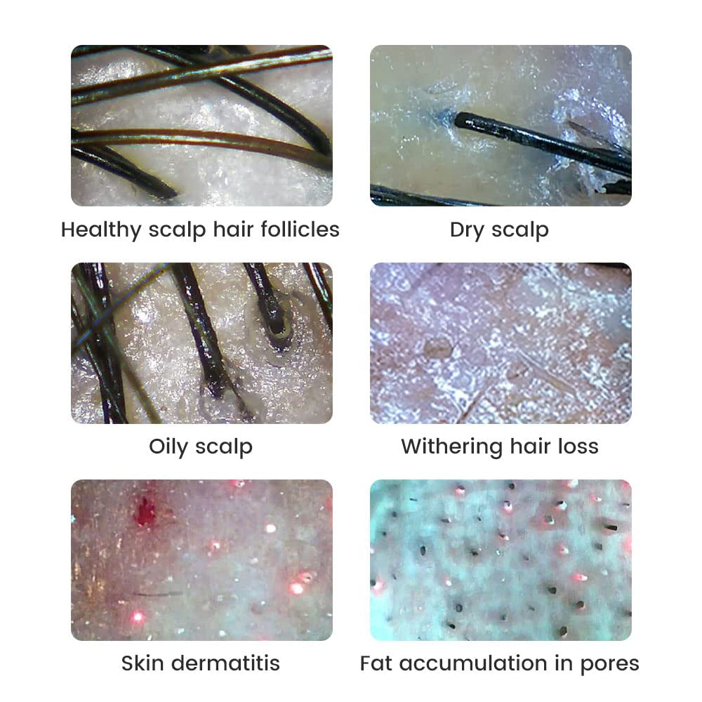 Wireless Skin Analyzer Machine Dermatoscope Scalp/Skin/Hair Follicle Detection 1000X