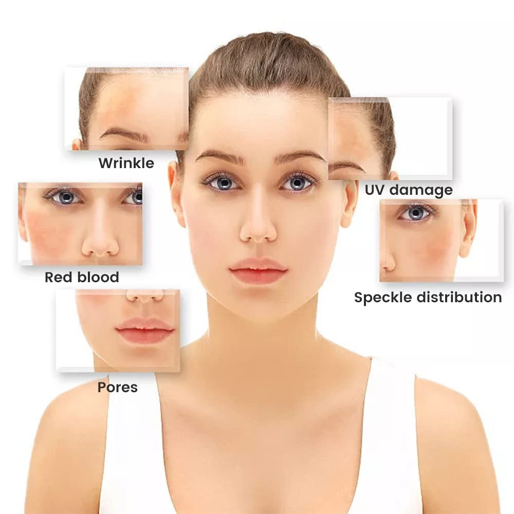 Wireless Skin Analyzer Machine Dermatoscope Scalp/Skin/Hair Follicle Detection 1000X